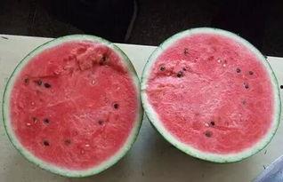 住院吃瓜,一场别开生面的“吃瓜”之旅